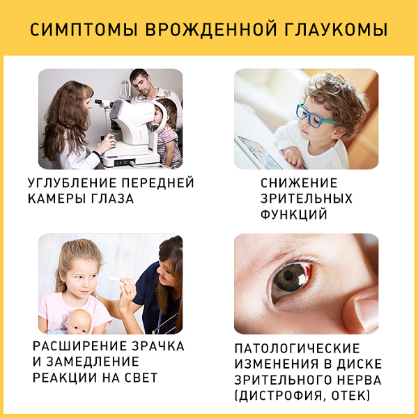 симптомы глаукомы у детей
