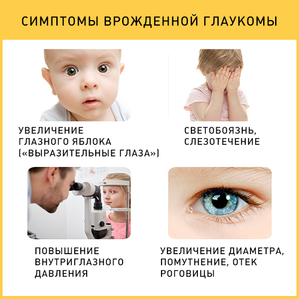 лечение глаукомы у детей