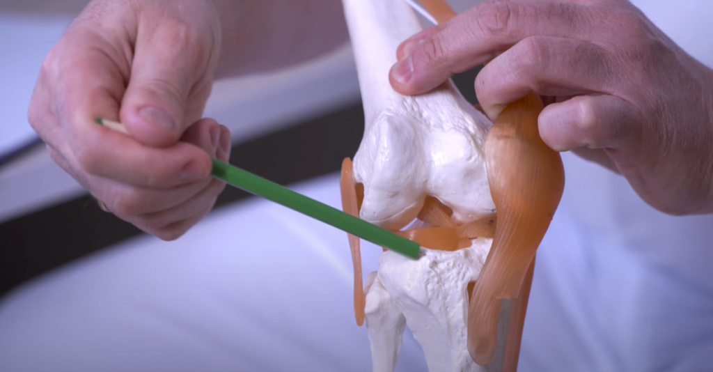 снимок коленного сустава при артроскопии
